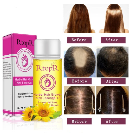 Hair Loss Essential Oil 20ml Fast Powerful Hair Growth Repair Thick Care