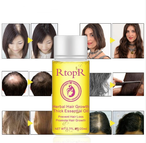 Hair Loss Essential Oil 20ml Fast Powerful Hair Growth Repair Thick Care