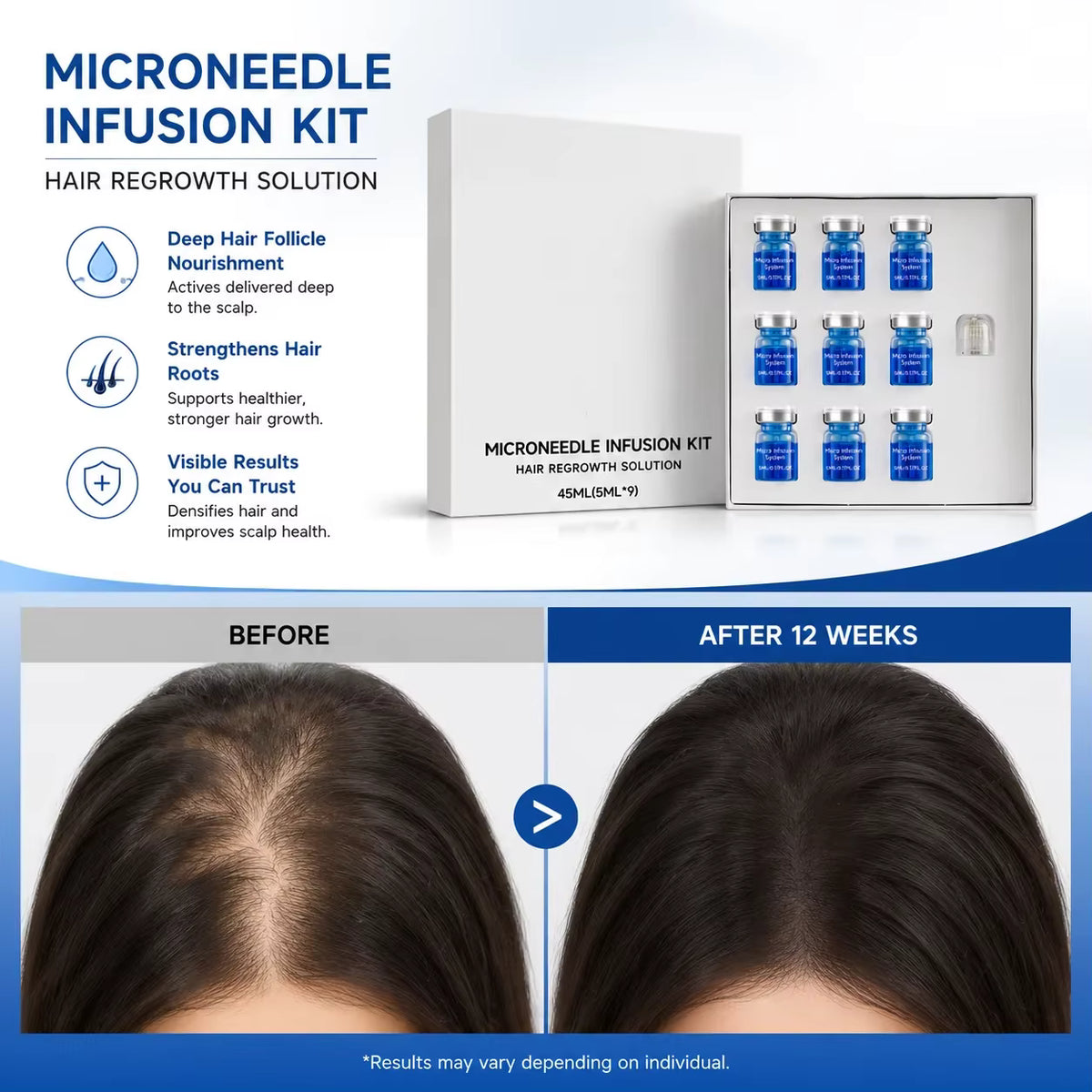 Microneedle Scalp Serum Hair Care Kit With Micro Needle Head Treatment 9x 5ml
