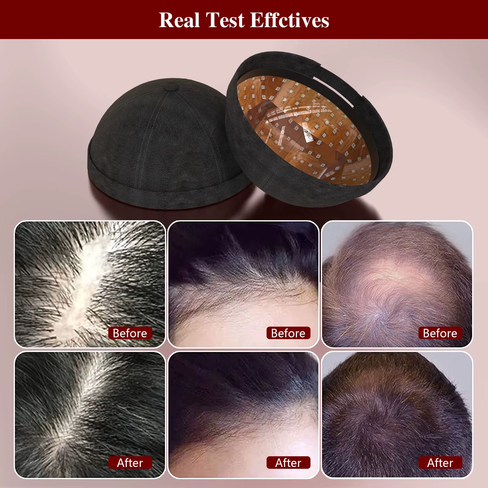 Hair Growth Hat - Promote Hair Regrowth with Red & Blue Light Therapy