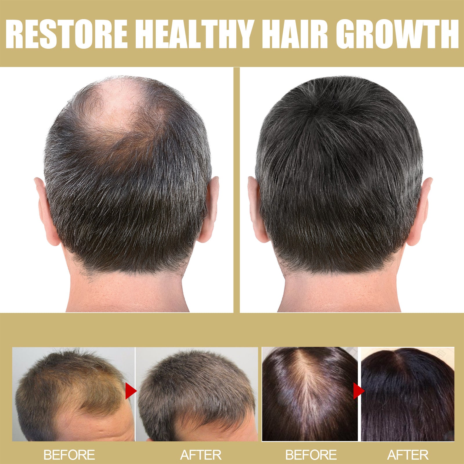 Hair Repair Heating Cap for Frizzy, Damaged Hair, and Hair Loss