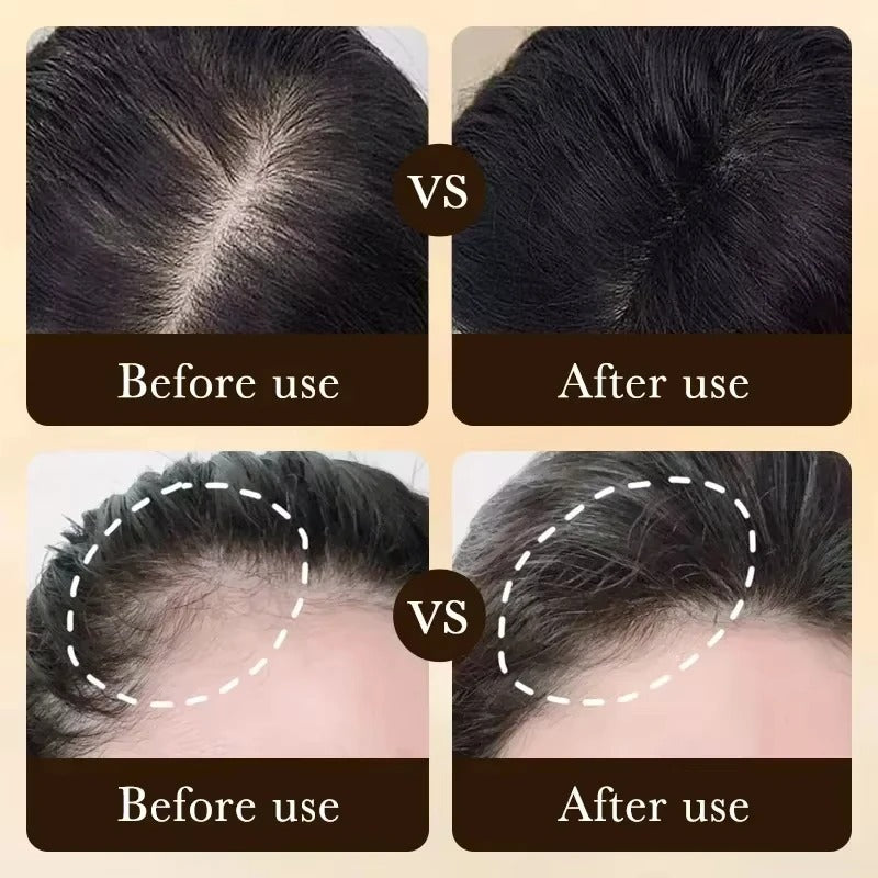 Hair Growth Serum Scalp Care Lightweight Non Greasy Strengthening Treatment