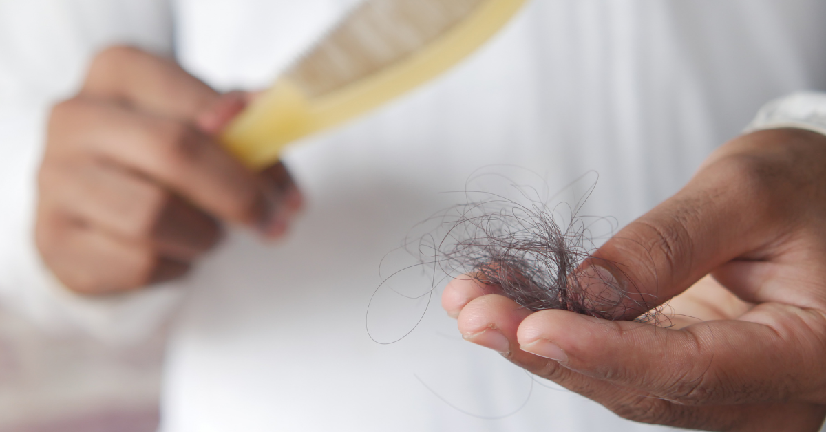 How to Avoid Hair Loss in Men and What Are the Causes?
