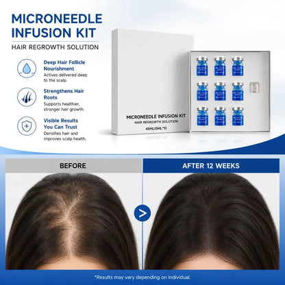 Microneedle Scalp Serum Hair Care Kit With Micro Needle Head Treatment 9x 5ml
