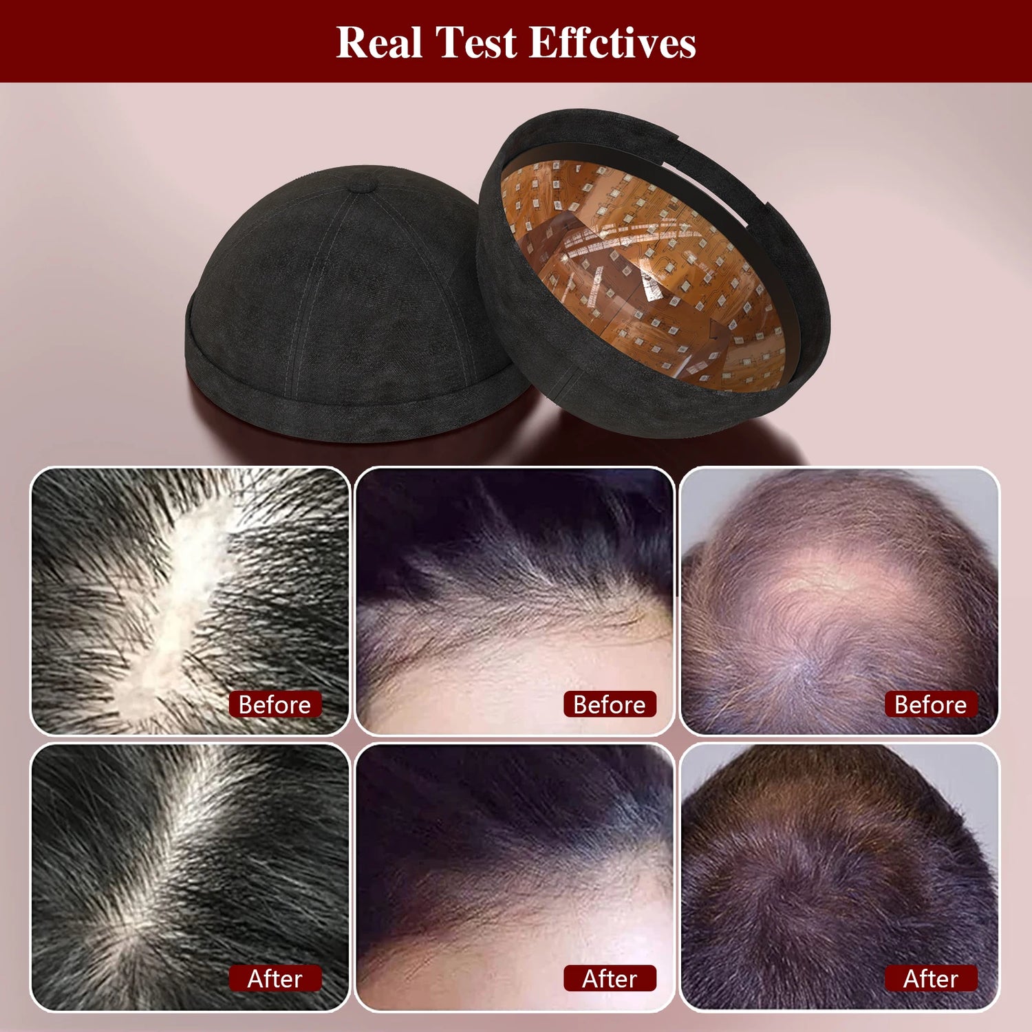 KTS Hair Growth Hat - Anti Hair Loss Device for Effective Regrowth