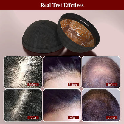 KTS Hair Growth Hat - Anti Hair Loss Device for Effective Regrowth