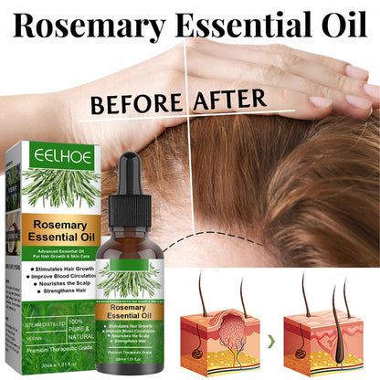 EELHOE Rosemary Essential Oil for Hair Growth