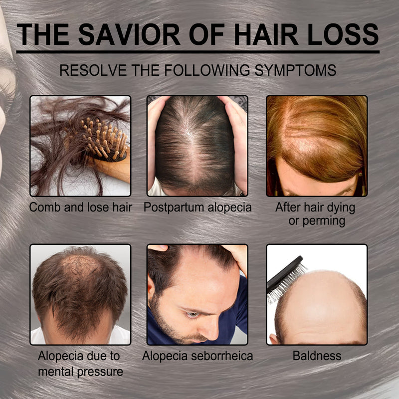 EELHOE Rosemary Essential Oil for Hair Growth