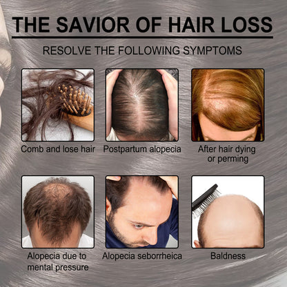 EELHOE Rosemary Essential Oil for Hair Growth