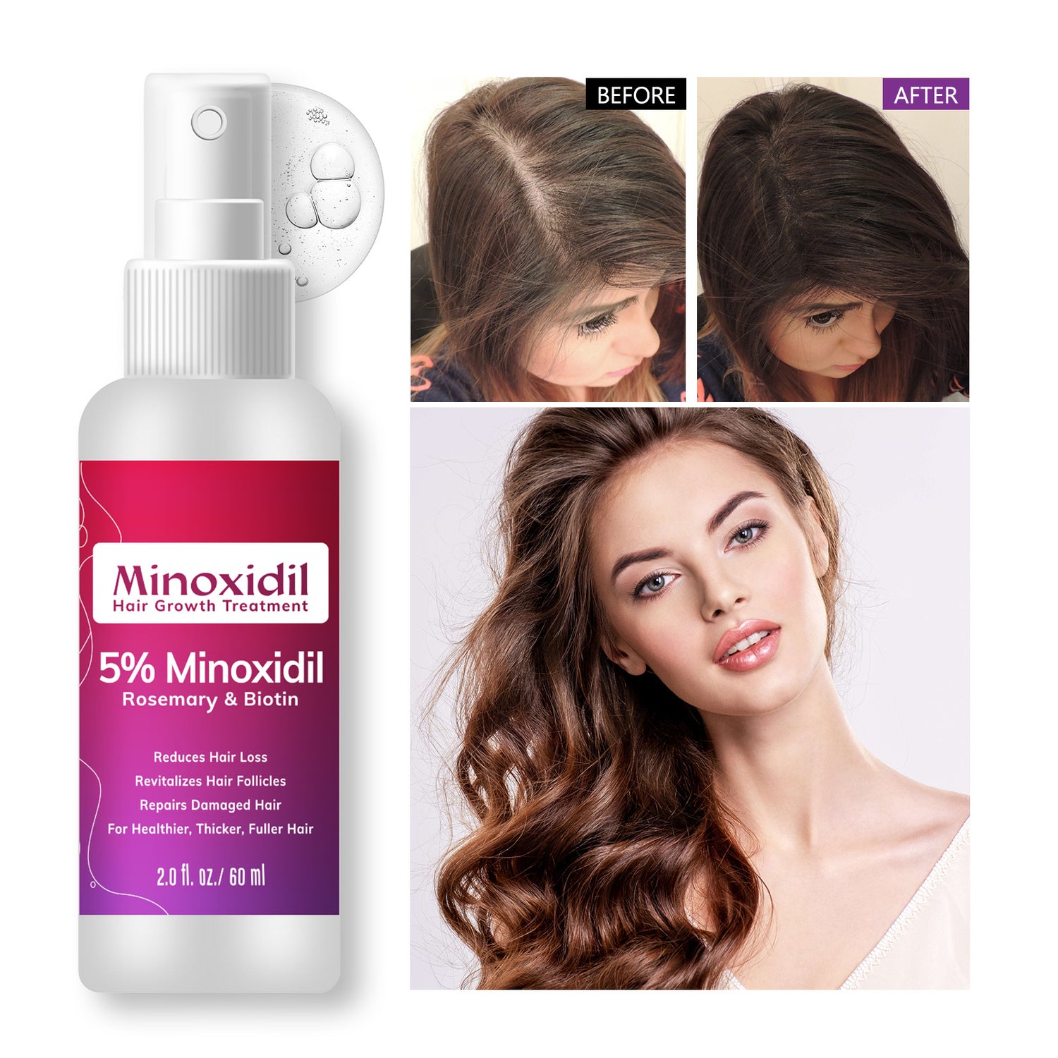 Hair Spray For Roots | Minoxidil Anti Hair Loss