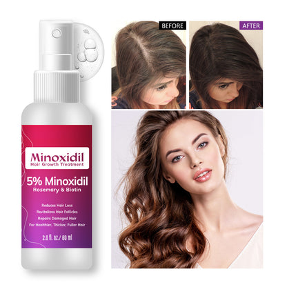 Hair Spray For Roots | Minoxidil Anti Hair Loss