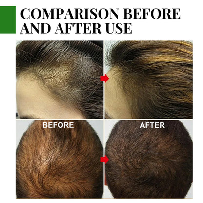 EELHOE Rosemary Essential Oil for Hair Growth