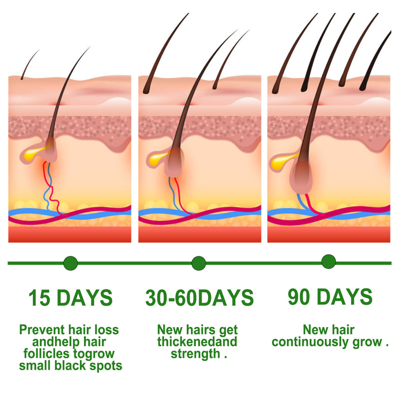 EELHOE Rosemary Essential Oil for Hair Growth