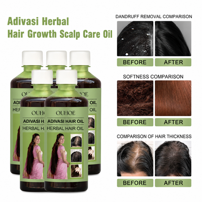 OUHOE Adivasi Hair Oil Herbal Oil Rosemary Hair Growth Amla Bhringraj Herbal 100ml