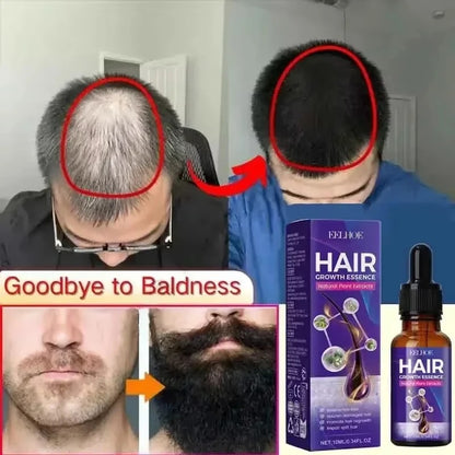 Hair Loss Treatment Growth Serum Scalp Nourishing Lightweight Non Greasy