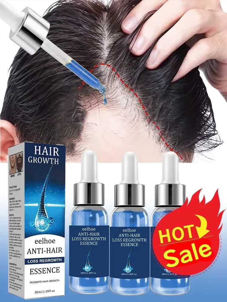 Hair Growth Serum Oil Caffeine Rosemary Biotin Scalp Care Thick Fuller Looking Hair 100ml