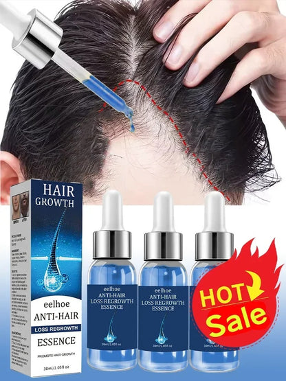 Hair Growth Serum Oil Caffeine Rosemary Biotin Scalp Care Thick Fuller Looking Hair 100ml