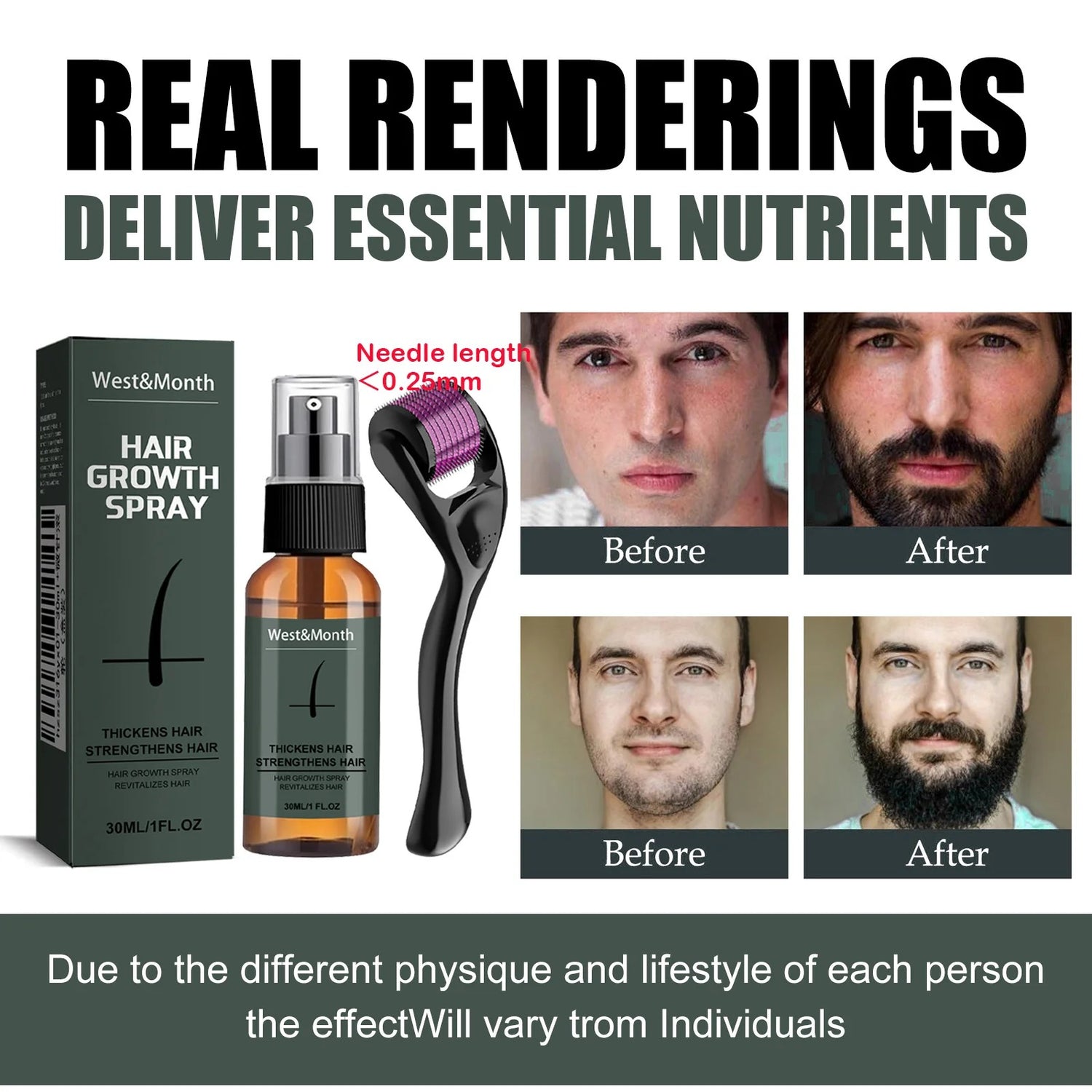Men’s Beard Thickening Spray Kit With 0.25mm Micro Roller And Serum