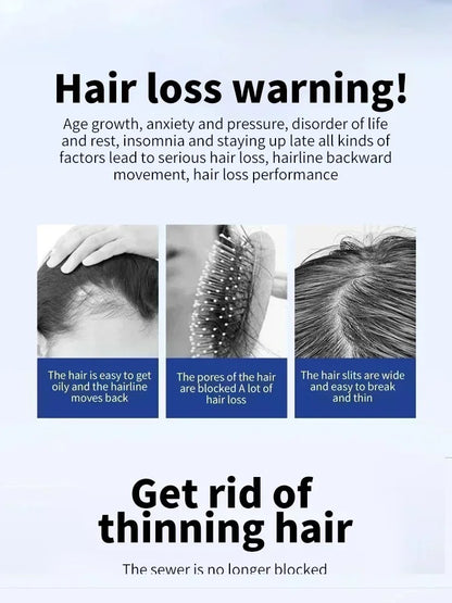 Hair Loss Treatment Growth Serum Scalp Nourishing Lightweight Non Greasy