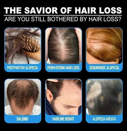 Hair Loss Treatment Growth Serum Scalp Nourishing Lightweight Non Greasy