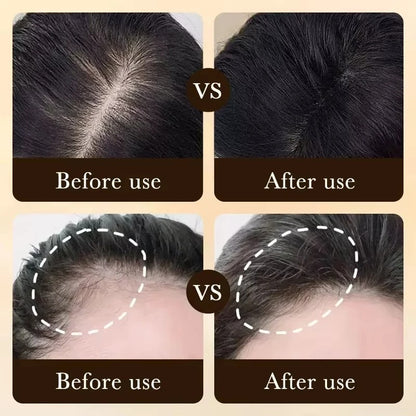 Hair Growth Serum Scalp Care Lightweight Non Greasy Strengthening Treatment
