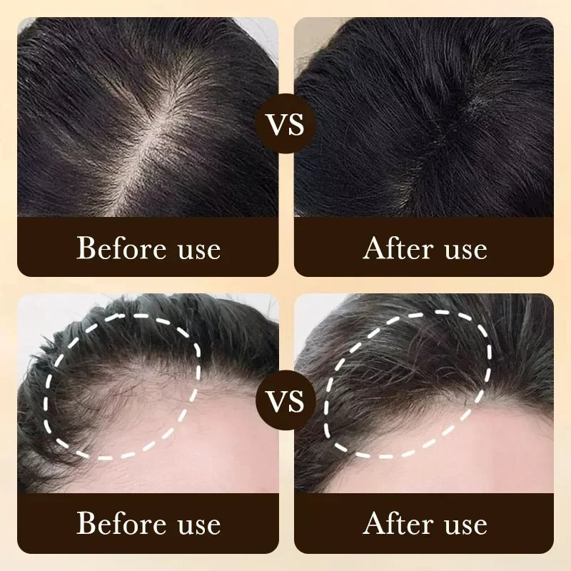 Biotin Hair Growth Serum For Men Thickening Scalp Treatment Hair Care Oil 20ml